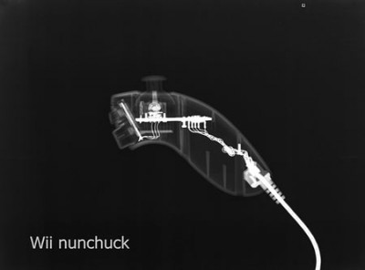 Wii nunchuck radiografia
